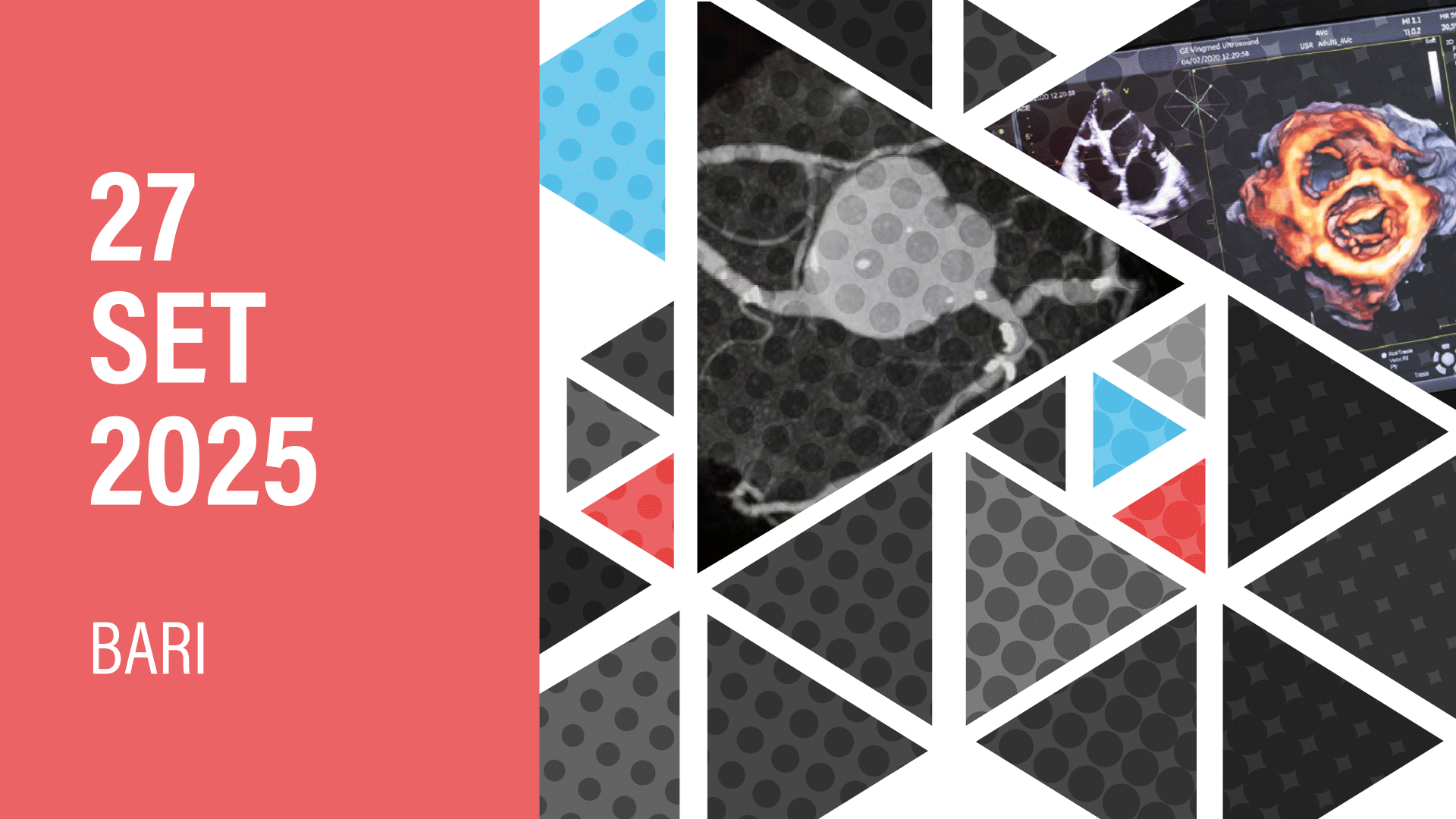CONGRESSO MICRO-AREA SIECVI PUGLIA I EDIZIONE L’ERA DEL MULTIMODALITY IMAGING
