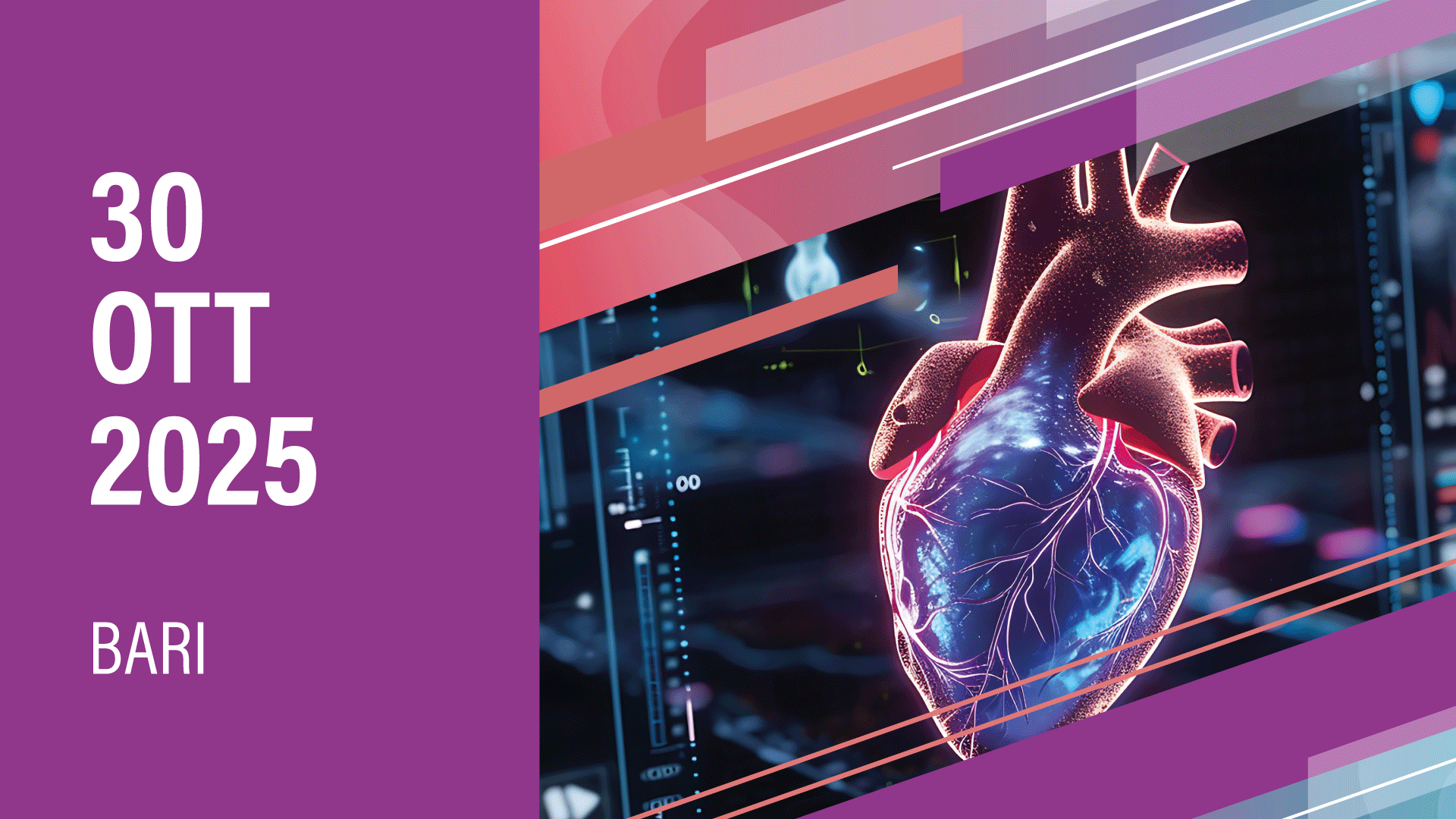 CARDIOMIOPATIA IPERTROFICA OSTRUTTIVA: DALLA DIAGNOSI ALLA GESTIONE NELLA REAL LIFE